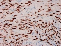 ORF73/HHV8 Antibody (HHV8/3606) - Azide and BSA Free, Novus Biologicals 100 &mu;g | Buy Online | Novus Biologicals | Fisher Scientific